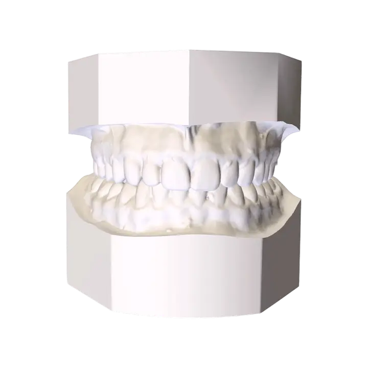Medical pathological model of upper and lower alveolar bone before orthodontic treatment 3D model preview on Freecreat